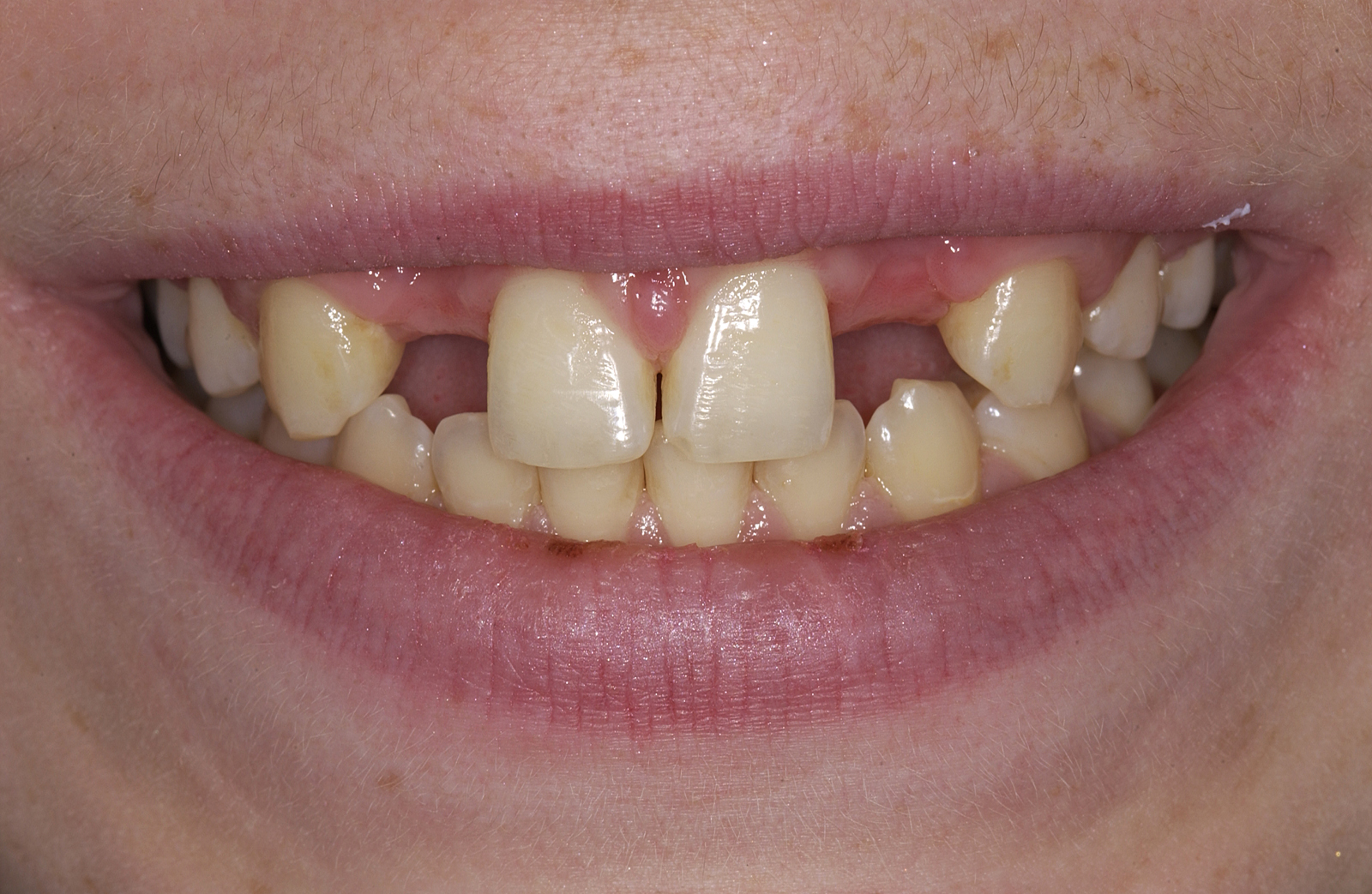 1 1