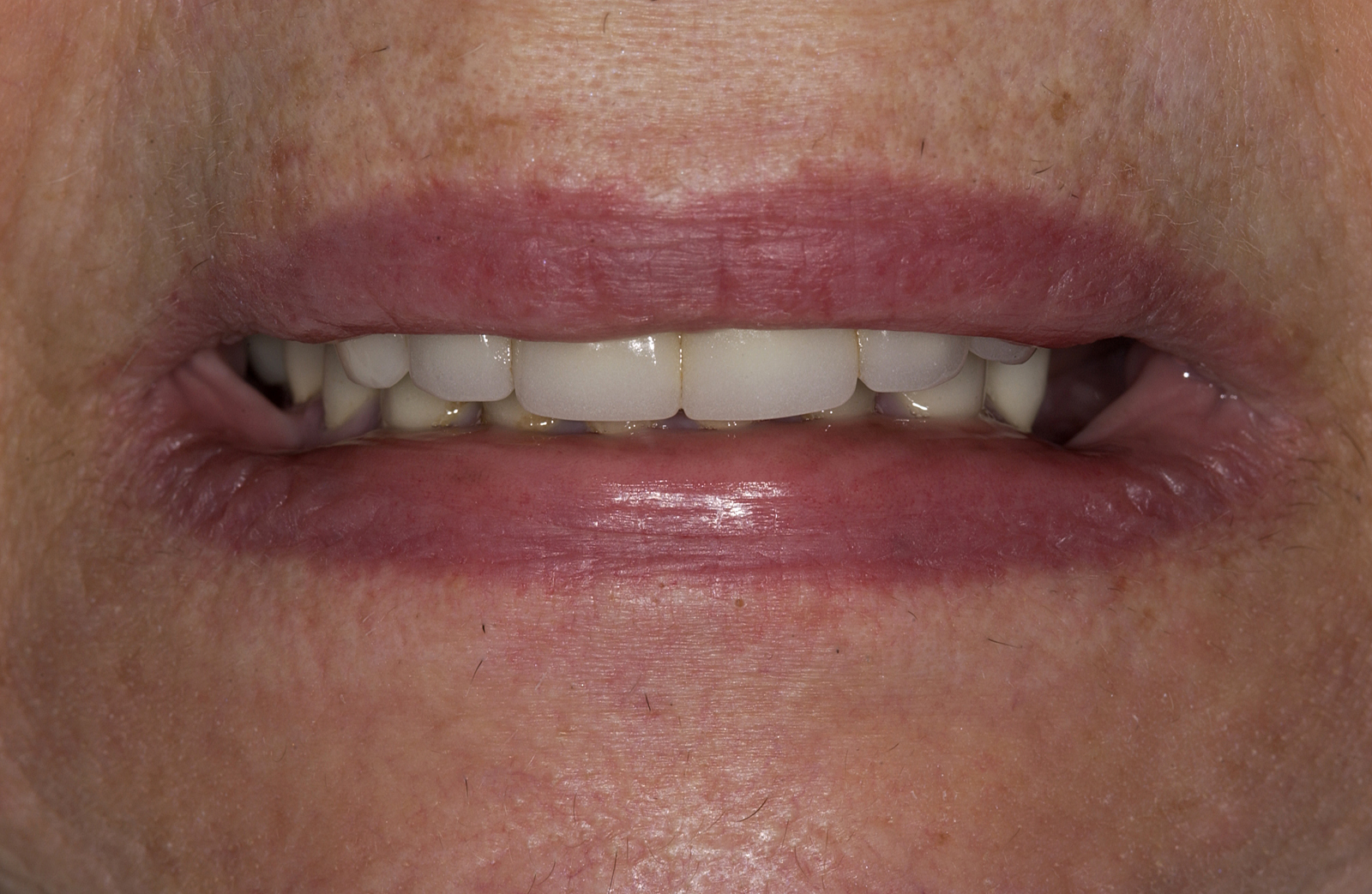 DSC_1519 DSC_1519