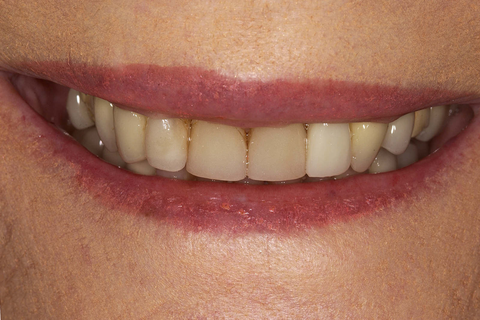 DSC_6115 DSC_6115
