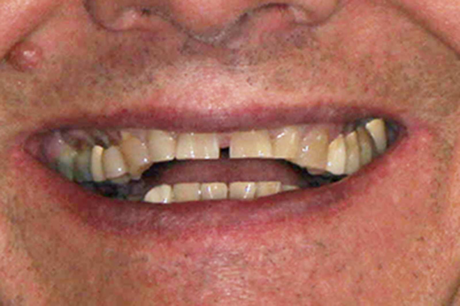 Smile 2 Smile 2