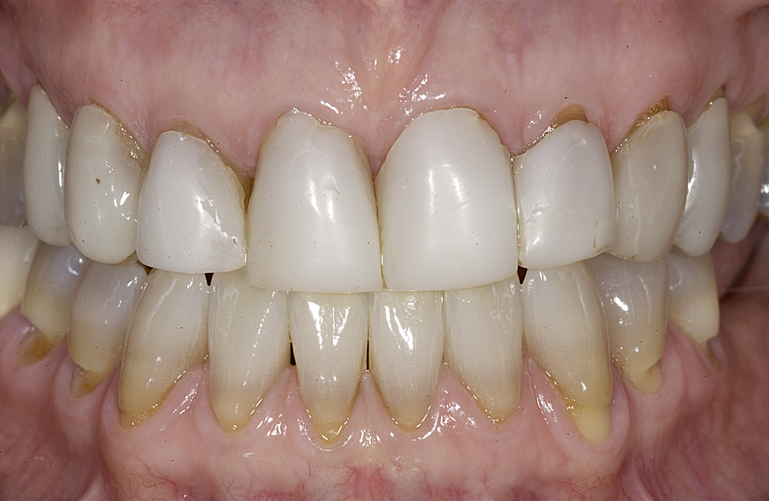 initial intraoral initial intraoral