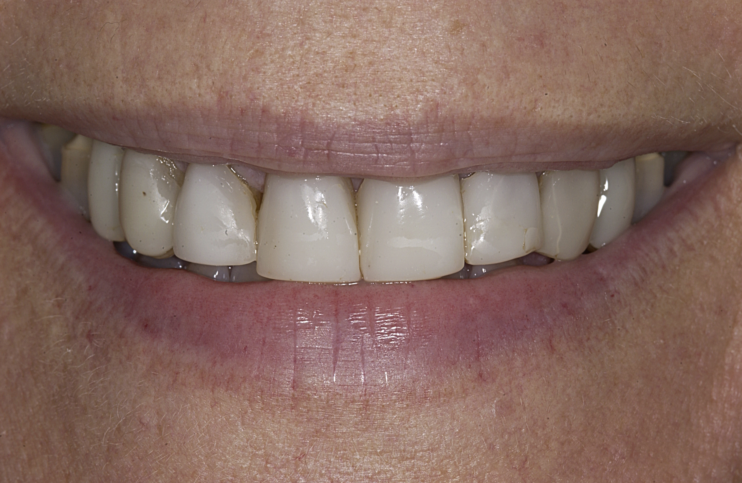 initial smile3 initial smile3