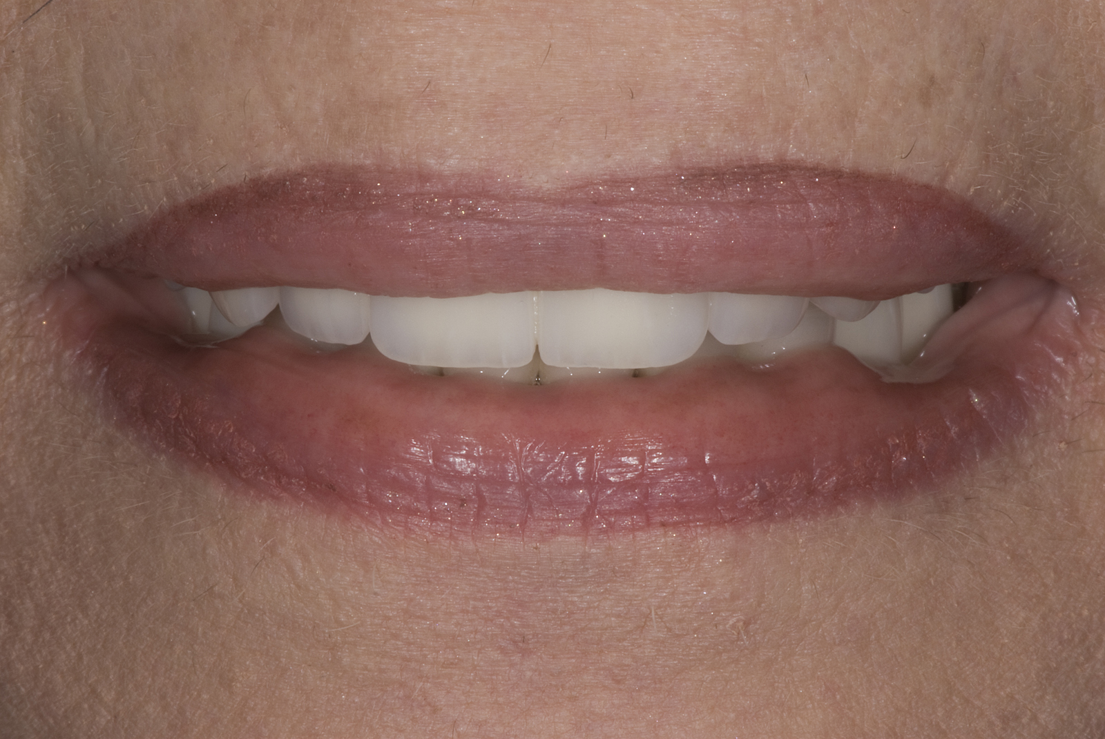 smilw smilw