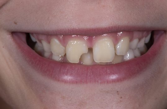 _DSC0613 _DSC0613